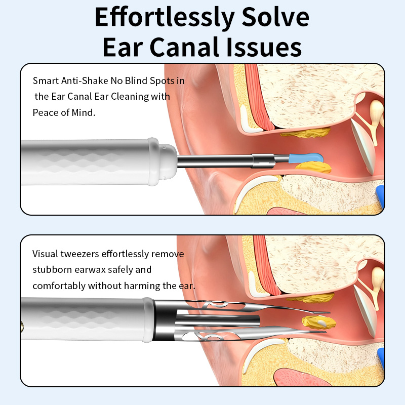 10-in-1 Endoscope B05 view 2